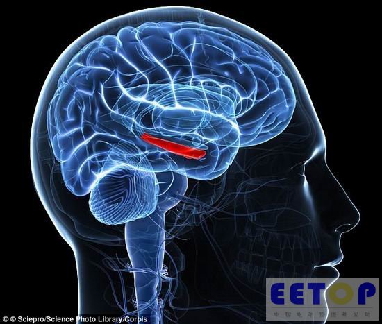 微芯片植入大脑可保存人们的大脑记忆内容