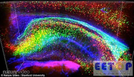 微芯片植入大脑可保存人们的大脑记忆内容