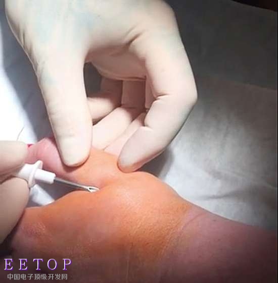 你愿意打一针把芯片植入体内吗